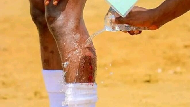 Football : un joueur professionnel doit éviter de jouer dans des mauvais terrains avec des joueurs non professionnels, voici 10 risques