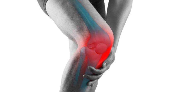 Santé : Voici l’astuce pour soulager l’arthrose