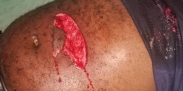 Walungu/Insécurité : une personne perd la vie et des biens emportés dans un cambriolage par des voleurs à mains armés sur la RN2 à Cagombe