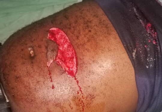 Walungu/Insécurité : une personne perd la vie et des biens emportés dans un cambriolage par des voleurs à mains armés sur la RN2 à Cagombe