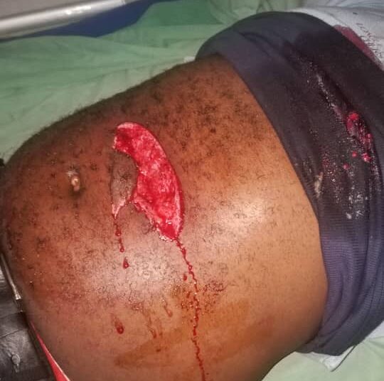 Walungu/Insécurité : une personne perd la vie et des biens emportés dans un cambriolage par des voleurs à mains armés sur la RN2 à Cagombe