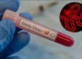 ‎Les radios communautaires en première ligne contre Ebola ‎